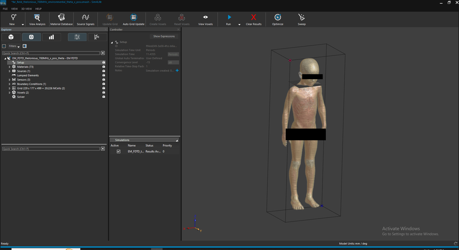 Thelonious phantom setup in Sim4Life GUI