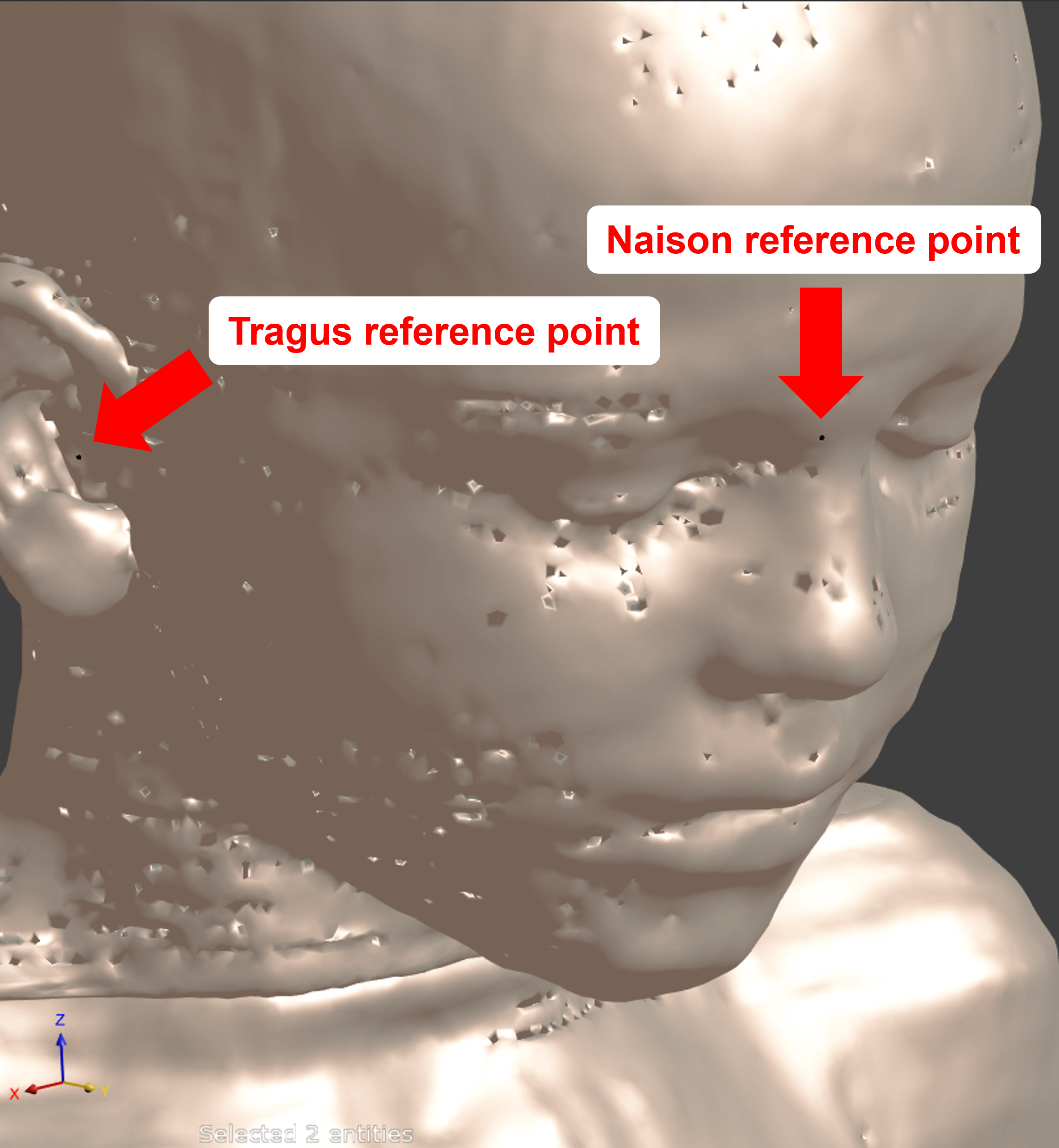 Anatomical reference points